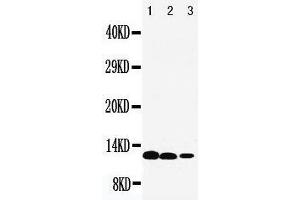 Anti-IL13 antibody, Western blotting Lane 1: Recombinant Human IL13 Protein 10ng Lane 2: Recombinant Human IL13 Protein 5ng Lane 3: Recombinant Human IL13 Protein 2. (IL-13 anticorps  (C-Term))