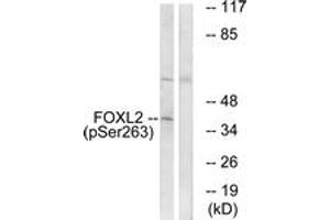 Western blot analysis of extracts from K562 cells treated with Na3VO4 0. (FOXL2 anticorps  (pSer263))
