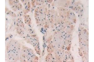 anti-Myosin Light Chain Kinase (MYLK) (AA 1661-1877) antibody