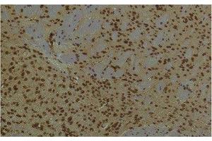 Immunohistochemistry of paraffin-embedded Mouse brain tissue using PI 3 kinase p85 alpha Monoclonal Antibody at dilution of 1:200. (PIK3R1 anticorps)