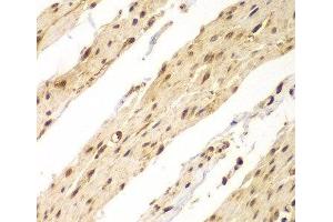 Immunohistochemistry of paraffin-embedded Human colon using CDX1 Polyclonal Antibody at dilution of 1:100 (40x lens). (CDX1 anticorps)