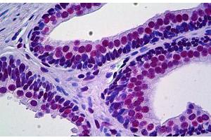 Human Prostate: Formalin-Fixed, Paraffin-Embedded (FFPE)