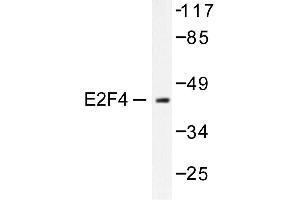 Image no. 1 for anti-E2F4/E2F5 (E2F4/5) antibody (ABIN265389) (E2F4/E2F5 (E2F4/5) anticorps)