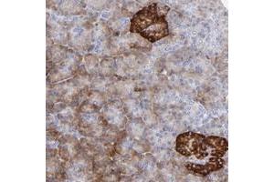 Immunohistochemical staining of human pancreas with LHFPL1 polyclonal antibody  shows strong cytoplasmic positivity in islet cells at 1:50-1:200 dilution.