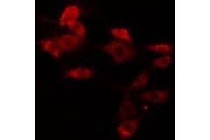 ABIN6275775 staining Hela cells by IF/ICC. (IFIT5 anticorps  (Internal Region))