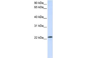 WB Suggested Anti-RAB18 Antibody Titration:  0. (RAB18 anticorps  (C-Term))