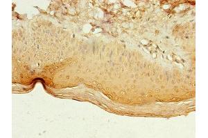 Immunohistochemistry of paraffin-embedded human skin tissue using ABIN7158260 at dilution of 1:100