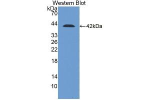 Detection of Recombinant DSC2, Human using Polyclonal Antibody to Desmocollin 2 (DSC2) (Desmocollin 2 anticorps  (AA 136-471))