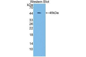 Western blot analysis of the recombinant protein. (SCARA5 anticorps  (AA 118-495))