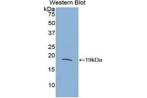 Western blot analysis of the recombinant protein. (RNASE3 anticorps  (AA 33-155))