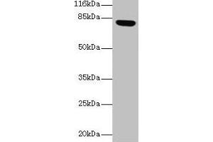 Western blot All lanes: Lhcgr antibody at 2 μg/mL + Rat gonadal tissue Secondary Goat polyclonal to rabbit IgG at 1/10000 dilution Predicted band size: 79, 35, 38, 73, 28, 33, 21, 72, 31, 34, 41 kDa Observed band size: 79 kDa (LHCGR anticorps  (AA 27-362))