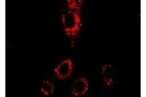 Immunofluorescent analysis of p43 staining in HepG2 cells. (p43 anticorps)