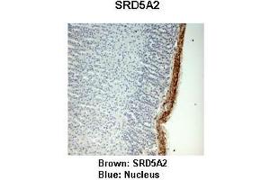 Sample Type :  Monkey adrenal gland   Primary Antibody Dilution :   1:25   Secondary Antibody:  Anti-rabbit-HRP   Secondary Antibody Dilution:   1:1000   Color/Signal Descriptions:  Brown: SRD5A2 Blue: Nucleus   Gene Name:  SRD5A2   Submitted by:  Jonathan Bertin, Endoceutics Inc. (SRD5A2 anticorps  (N-Term))