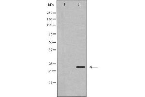 Western blot analysis of CD69 expression in Jurkat cell lysate,The lane on the left is treated with the antigen-specific peptide. (CD69 anticorps  (Internal Region))