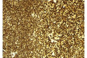 ABIN6276320 at 1/100 staining Mouse spleen tissue by IHC-P.