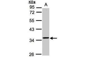 WB Image Sample(30 ug whole cell lysate) A:Raji , 10% SDS PAGE antibody diluted at 1:1000