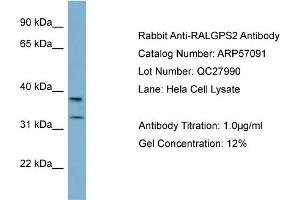 WB Suggested Anti-RALGPS2  Antibody Titration: 0. (RALGPS2 anticorps  (N-Term))