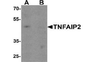 Western blot analysis of TNFAIP2 in K562 cell lysate with TNFAIP2 Antibody  at 1 ug/ml in (A) the absence and (B) the presence of blocking peptide. (TNFAIP2 anticorps  (Middle Region))