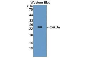 Western Blotting (WB) image for anti-Cerebral Dopamine Neurotrophic Factor (CDNF) (AA 20-183) antibody (ABIN1176537) (CDNF anticorps  (AA 20-183))