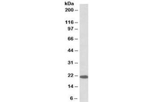 Western blot testing of human cerebellum lysate with Dnajc5 antibody at 0. (DNAJC5 anticorps)