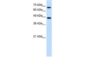 WB Suggested Anti-NR4A2 Antibody Titration:  0.