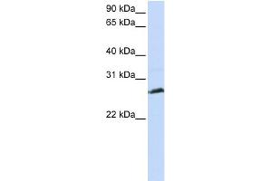 WB Suggested Anti-SYCP3 Antibody Titration: 0. (SYCP3 anticorps  (N-Term))