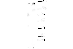 AIB1 antibody (pAb) tested by Western blot.
