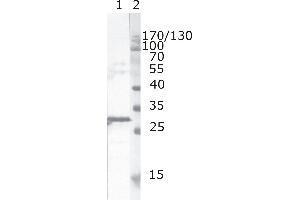 Western Blot testing of HIV-1 recombinant Nef protein. (HIV-1 Nef (AA 163-173) anticorps)