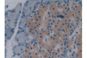Detection of TXNRD1 in Rat Pancreas Tissue using Polyclonal Antibody to Thioredoxin Reductase 1 (TXNRD1)