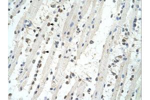 Immunohistochemistry (IHC) image for anti-Tripartite Motif Containing 32 (TRIM32) (C-Term) antibody (ABIN309924) (TRIM32 anticorps  (C-Term))