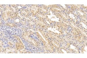 Detection of HIF2a in Human Kidney Tissue using Polyclonal Antibody to Hypoxia Inducible Factor 2 Alpha (HIF2a)