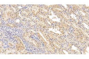 Detection of HIF2a in Human Kidney Tissue using Polyclonal Antibody to Hypoxia Inducible Factor 2 Alpha (HIF2a) (EPAS1 anticorps  (AA 26-347))