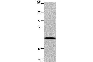 Western blot analysis of Human hepatocellular carcinoma tissue, using CYP1A2 Polyclonal Antibody at dilution of 1:440 (CYP1A2 anticorps)