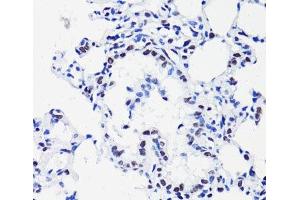 Immunohistochemistry of paraffin-embedded Rat lung using Acetyl-Histone H2B-K15 Polyclonal Antibody at dilution of 1:100 (40x lens). (Histone H2B anticorps  (acLys15))