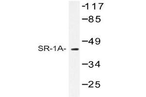 Image no. 1 for anti-Serotonin Receptor 1A (HTR1A) antibody (ABIN272268) (Serotonin Receptor 1A anticorps)