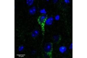 Confocal image (3 µm) of ABIN238557 (0.