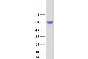 Validation with Western Blot