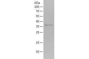 Western Blotting (WB) image for Hemoglobin, gamma A (HBG1) (AA 1-125) protein (His-IF2DI Tag) (ABIN7123294)