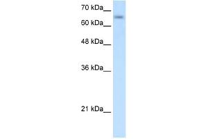 SLC39A12 antibody used at 0.