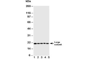 Western blot testing of Caspase-4 antibody and Lane 1:  MCF-7;  2: HeLa;  3: Jurkat;  4: CEM;  5: SW620 cell lysate