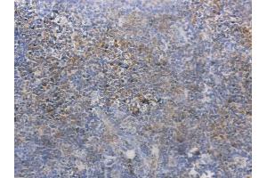 ABIN6262516 and ABIN6269410 at 1/100 staining human normal tonsil tissue by IHC-P.