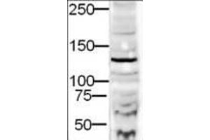 Western blot using  Affinity Purified anti-DIA-2 antibody shows detection of a 132-kDa band corresponding to DIA-2 in a lysate prepared from human derived HEK293 cells. (DIA2 anticorps  (AA 1085-1101))