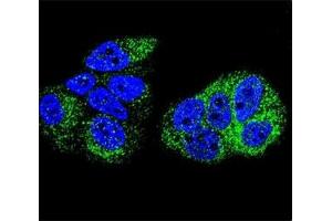 Confocal immunofluorescent analysis of HNF4A antibody with MCF-7 cells followed by Alexa Fluor 488-conjugated goat anti-rabbit lgG (green).