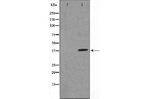 Western blot analysis of IkappaB-alpha expression in TNF-α treated MCF7 whole cell lysates,The lane on the left is treated with the antigen-specific peptide. (NFKBIA anticorps  (N-Term))