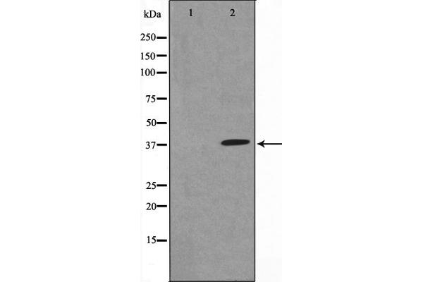 NFKBIA antibody  (N-Term)