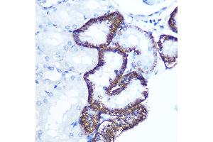Immunohistochemistry of paraffin-embedded rat kidney using EXTL3 Rabbit pAb (ABIN1679782, ABIN3018195, ABIN3018196 and ABIN6220395) at dilution of 1:100 (40x lens). (EXTL3 anticorps  (AA 52-220))