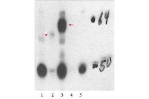 Western Blotting (WB) image for anti-Thyroid Hormone Receptor, beta (THRB) (Isoform 1), (N-Term) antibody (ABIN964895) (THRB anticorps  (Isoform 1, N-Term))
