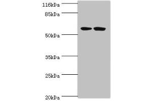 Western blot All lanes: DCAF4 antibody at 2 μg/mL Lane 1: 293T whole cell lysate Lane 2: Hela whole cell lysate Secondary Goat polyclonal to rabbit IgG at 1/10000 dilution Predicted band size: 56, 49, 45, 55 kDa Observed band size: 56 kDa (DCAF4 anticorps  (AA 1-495))