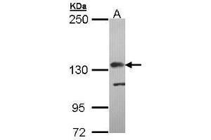 WB Image Sample (30 ug of whole cell lysate) A: Molt-4 , 5% SDS PAGE antibody diluted at 1:5000 (Complement Factor H anticorps)