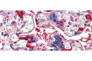 Rabbit Anti-LDHB Antibody  arp48210 Paraffin Embedded Tissue: Human Placenta Antibody Concentration: 5 ug/ml